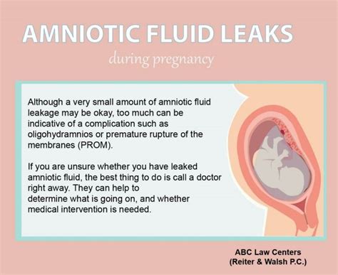 does leaking amniotic fluid smell|Leaking Amniotic Fluid: Signs in 1st to 3rd Trimester